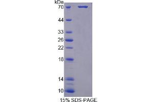 Image no. 1 for Pepsinogen C (PGC) (AA 17-392) protein (His tag,GST tag) (ABIN6236610)