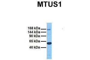 Image no. 6 for anti-Microtubule Associated Tumor Suppressor 1 (MTUS1) (Middle Region) antibody (ABIN2781855)
