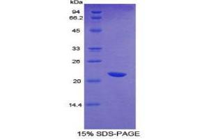 Image no. 1 for CD36 (CD36) (AA 45-203) protein (His tag,T7 tag) (ABIN1879477)