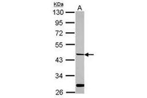 Image no. 1 for anti-Hepsin (HPN) (AA 202-400) antibody (ABIN1498709)
