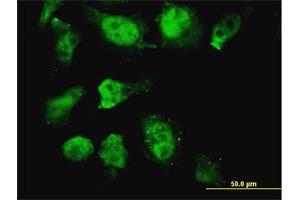 Image no. 1 for anti-Homeobox D11 (HOXD11) (AA 1-76) antibody (ABIN561358)