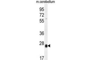 Image no. 1 for anti-Scleraxis (SCXA) antibody (ABIN5015284)