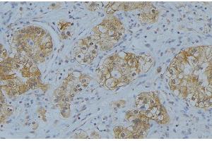 Image no. 4 for anti-Collagen, Type IV, alpha 2 (COL4A2) (N-Term) antibody (ABIN6258413)