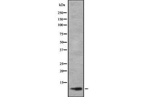 Image no. 1 for anti-T-Cell Acute Lymphocytic Leukemia 2 (TAL2) (C-Term) antibody (ABIN6265447)