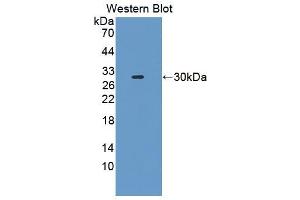 Image no. 2 for anti-Biotinidase (BTD) (AA 42-271) antibody (ABIN1866950)