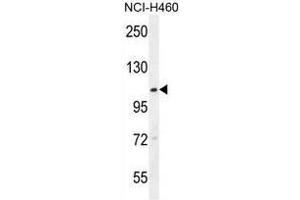 Image no. 3 for anti-Acyl-CoA Dehydrogenase Family, Member 10 (ACAD10) (AA 396-425), (Middle Region) antibody (ABIN950222)