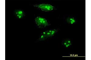 Immunofluorescence of purified MaxPab antibody to MKI67IP on HeLa cell.