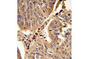 Image no. 1 for anti-Peroxisomal Biogenesis Factor 16 (PEX16) (AA 254-283), (Middle Region) antibody (ABIN954098)