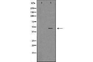 Image no. 2 for anti-Betaine--Homocysteine S-Methyltransferase (BHMT) (C-Term) antibody (ABIN6260258)