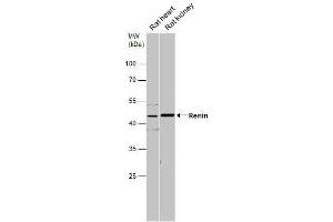 Image no. 1 for anti-Renin (REN) (Internal Region) antibody (ABIN2856174)