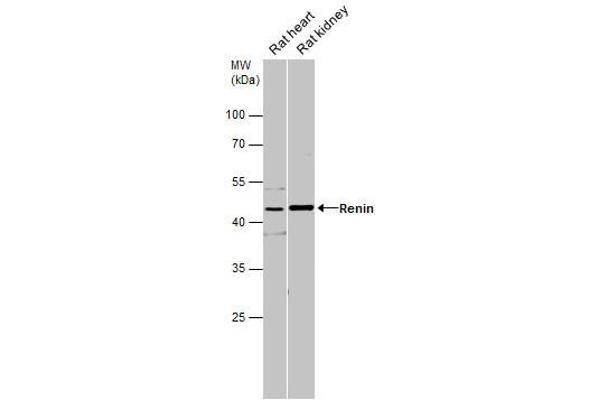 anti-Renin (REN) (Internal Region) antibody