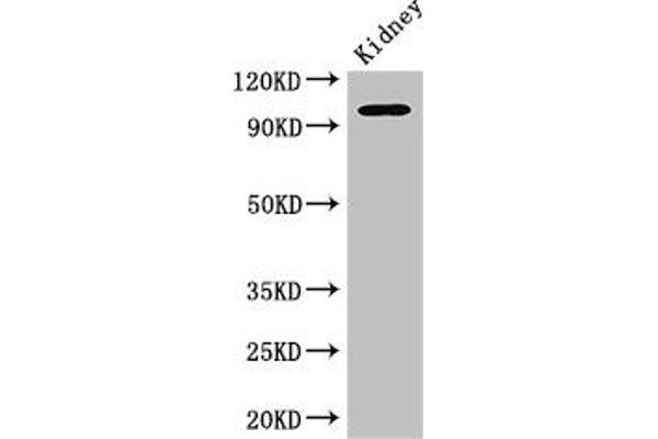 AAK1 anticorps  (AA 274-465)
