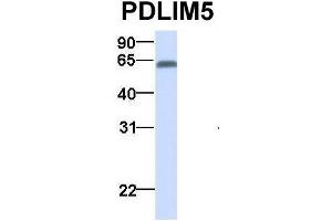 Image no. 6 for anti-PDZ and LIM Domain 5 (PDLIM5) (N-Term) antibody (ABIN2780775)