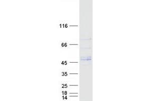Image no. 1 for Leucine Rich Repeat Containing 42 (LRRC42) protein (Myc-DYKDDDDK Tag) (ABIN2724918)