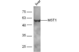 Image no. 2 for anti-Macrophage Stimulating 1 (Hepatocyte Growth Factor-Like) (MST1) (AA 385-487) antibody (ABIN747308)