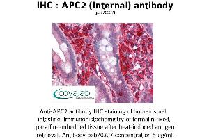 Image no. 2 for anti-APC Regulator of WNT Signaling Pathway 2 (APC2) (Internal Region) antibody (ABIN1731845)