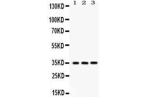 Image no. 2 for anti-N-Myc (And STAT) Interactor (NMI) (AA 2-307) antibody (ABIN3043451)