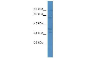 CA5A antibody  (C-Term)