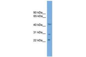 Image no. 1 for anti-MOK Protein Kinase (MOK) (AA 251-300) antibody (ABIN6746468)