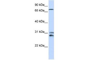 Image no. 1 for anti-Tousled-Like Kinase 2 (TLK2) (N-Term) antibody (ABIN630861)