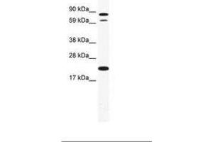 Image no. 1 for anti-Zinc Finger Protein 287 (ZNF287) (AA 104-153) antibody (ABIN202903)