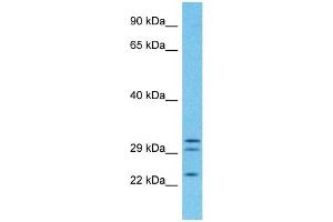 Image no. 2 for anti-Progesterone Receptor Membrane Component 1 (PGRMC1) (C-Term) antibody (ABIN5671769)