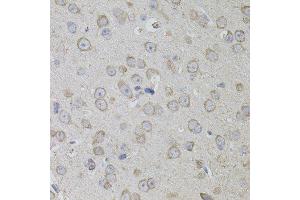 Image no. 3 for anti-CD59 (CD59) antibody (ABIN3022399)