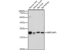 NIPSNAP1 antibody
