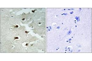 Image no. 1 for anti-Cell Division Cycle Associated 4 (CDCA4) (AA 121-170) antibody (ABIN1534323)