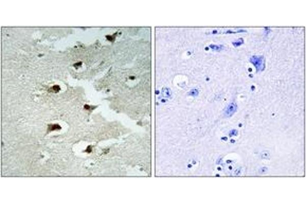 anti-Cell Division Cycle Associated 4 (CDCA4) (AA 121-170) antibody