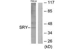 Image no. 1 for anti-Sex Determining Region Y (SRY) (AA 51-100) antibody (ABIN1533837)