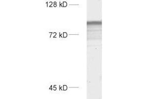 Image no. 2 for anti-Synaptopodin (SYNPO) (AA 331-452), (Isoform 2) antibody (ABIN1742348)