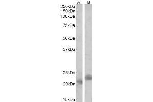 Image no. 2 for anti-PYD and CARD Domain Containing (PYCARD) (Internal Region) antibody (ABIN1590015)