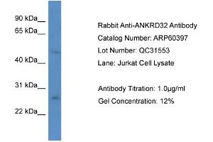Western Blotting (WB) image for anti-Ankyrin Repeat Domain 32 (ANKRD32) (N-Term) antibody (ABIN2774286)