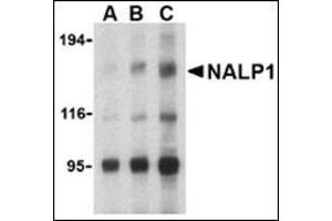 Image no. 2 for anti-NLR Family, Pyrin Domain Containing 1 (NLRP1) (C-Term) antibody (ABIN500310)