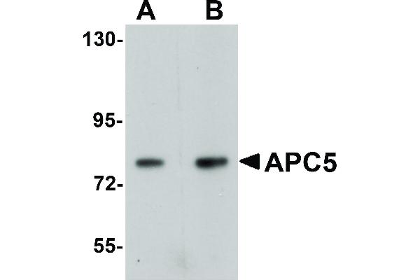 ANAPC5 抗体  (Internal Region)