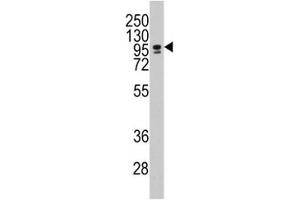 Image no. 2 for anti-CCAAT/enhancer Binding Protein (C/EBP), zeta (CEBPZ) (AA 1001-1029) antibody (ABIN3028540)