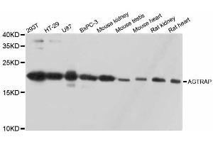 AGTRAP antibody  (AA 93-152)