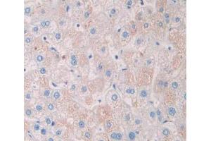 Image no. 2 for anti-Tissue Specific Transplantation Antigen P35B (TSTA3) (AA 1-321) antibody (ABIN5014407)