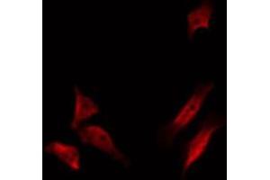 Image no. 4 for anti-Heat Shock 70kDa Protein 9 (Mortalin) (HSPA9) antibody (ABIN6262097)