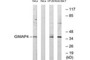 Image no. 1 for anti-GTPase, IMAP Family Member 4 (GIMAP4) (AA 131-180) antibody (ABIN1534959)