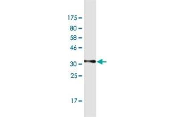 anti-Nebulin Related Anchoring Protein (NRAP) (AA 1640-1727) antibody