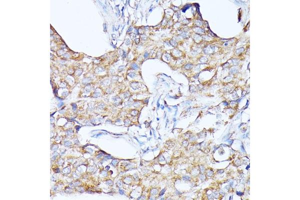 Cathepsin F anticorps  (AA 270-484)