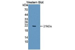 Image no. 1 for anti-Interleukin 1 Family Member 9 (IL1F9) (AA 1-158) antibody (ABIN1868601)