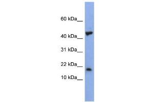 Image no. 2 for anti-LSM1 Homolog, U6 Small Nuclear RNA Associated (LSM1) (Middle Region) antibody (ABIN2779063)