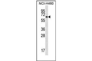 Image no. 1 for anti-Zinc Finger Protein 340 (ZNF340) (AA 250-279), (Middle Region) antibody (ABIN950685)