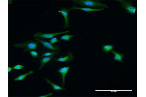 Image no. 2 for anti-Dystrobrevin Binding Protein 1 (DTNBP1) (AA 1-351) antibody (ABIN529551)