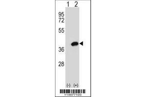 Image no. 3 for anti-Aldo-Keto Reductase Family 1, Member B1 (Aldose Reductase) (AKR1B1) (AA 102-135) antibody (ABIN389206)