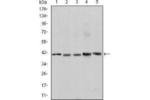 Image no. 3 for anti-REL proto-oncogene (c-Rel) antibody (ABIN968997)
