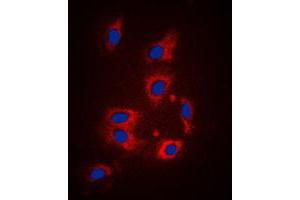 Image no. 1 for anti-Coagulation Factor II (thrombin) Receptor (F2R) (N-Term) antibody (ABIN2707688)
